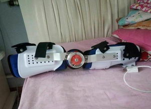 假肢矯形器價格解析與蕪湖德康假肢矯形器服務(wù)介紹